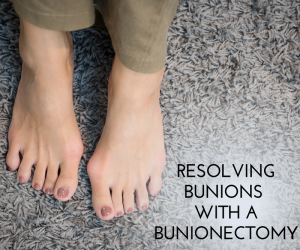 Resolving Bunions Through Bunionectomy: Restoring Comfort and Mobility